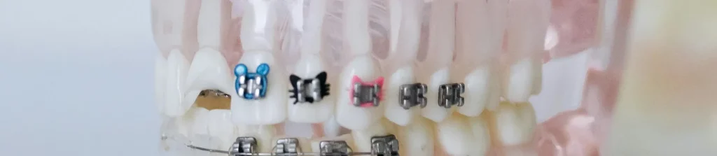 Appareil dentaire Dental Austral